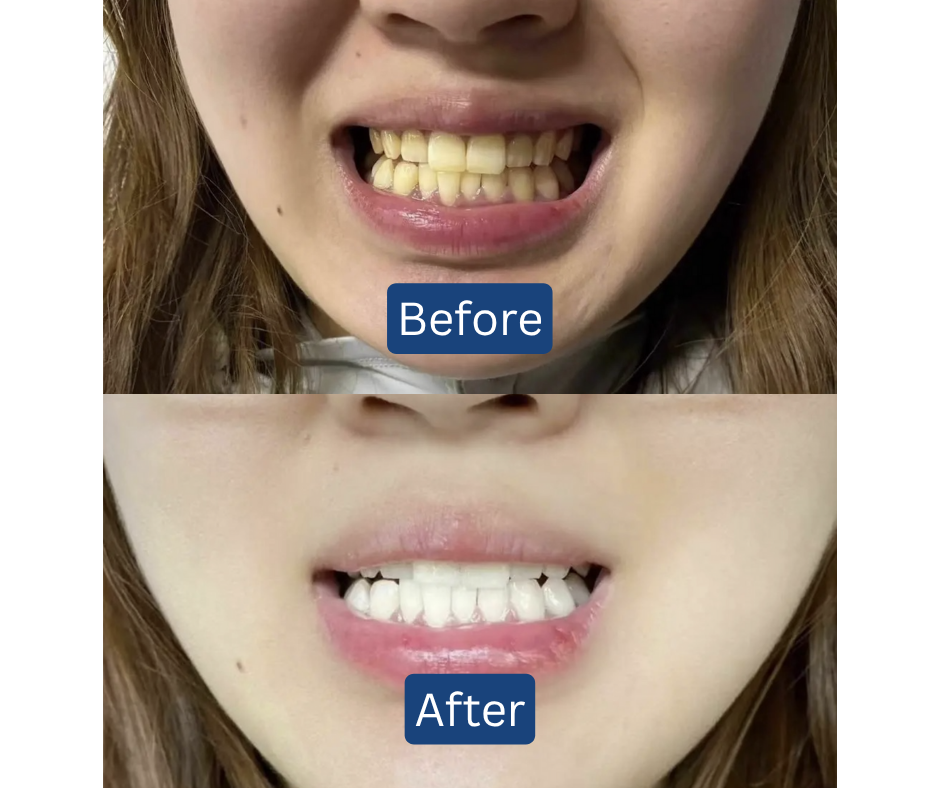 11.11 BIGGEST DEAL! RM3 for 3 Toothpowder💎