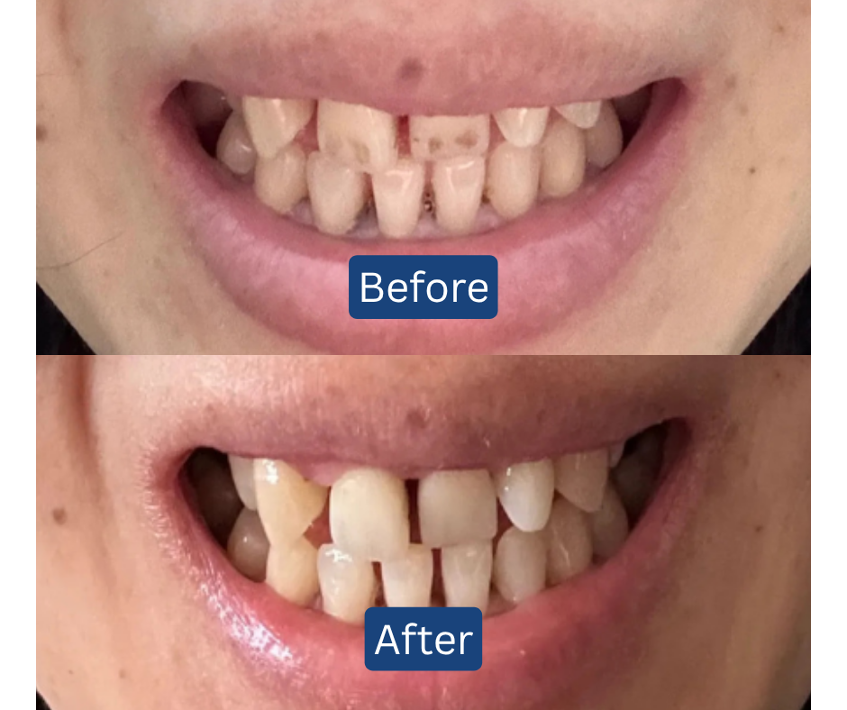 11.11 BIGGEST DEAL! RM3 for 3 Toothpowder💎